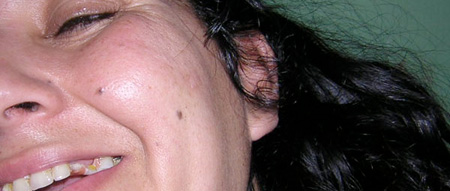 Woman Teeth